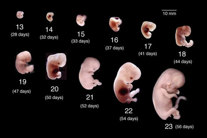 Fetal Evre